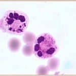 Zini_piattaforme_di-diagnosi_in ematologia_Figura_67