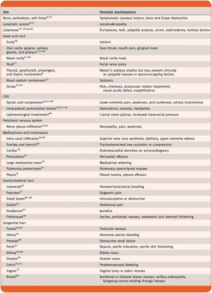 Ferrara_LA_LEUCEMIA_MIELOIDE_ACUTA_A_LOCALIZZAZIONE_EXTRA-MIDOLLARE _Tabella_1